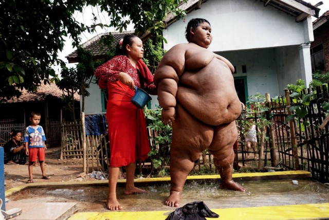 Самый толстый мальчик в мире сбросил половину своего веса