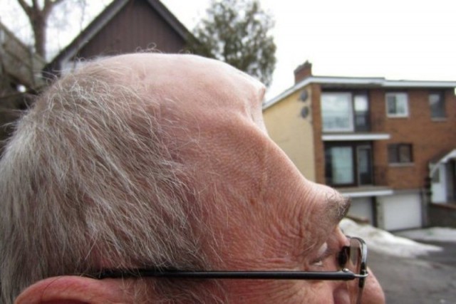 Человеческое сознание может обойтись без 90% мозга. Клинический опыт