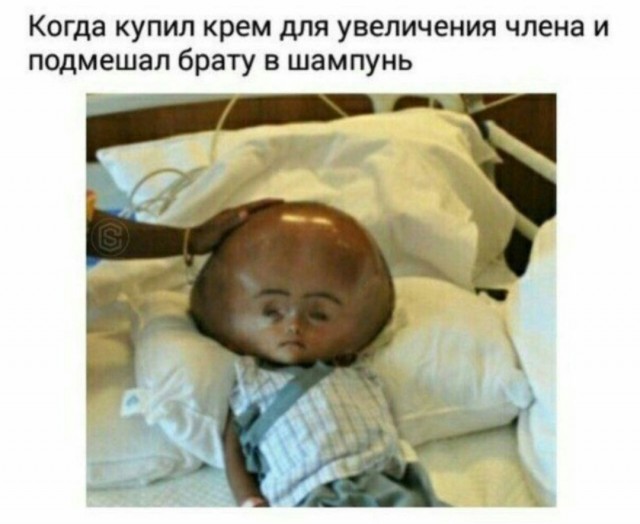 Бредзона 21.03.2021