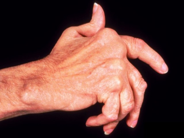 Что я буду делать в 65 лет