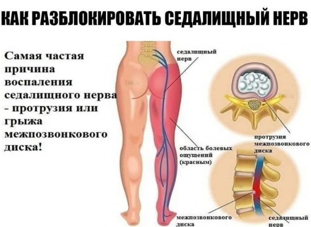 Топ-10 недостатков конструкции человеческого тела