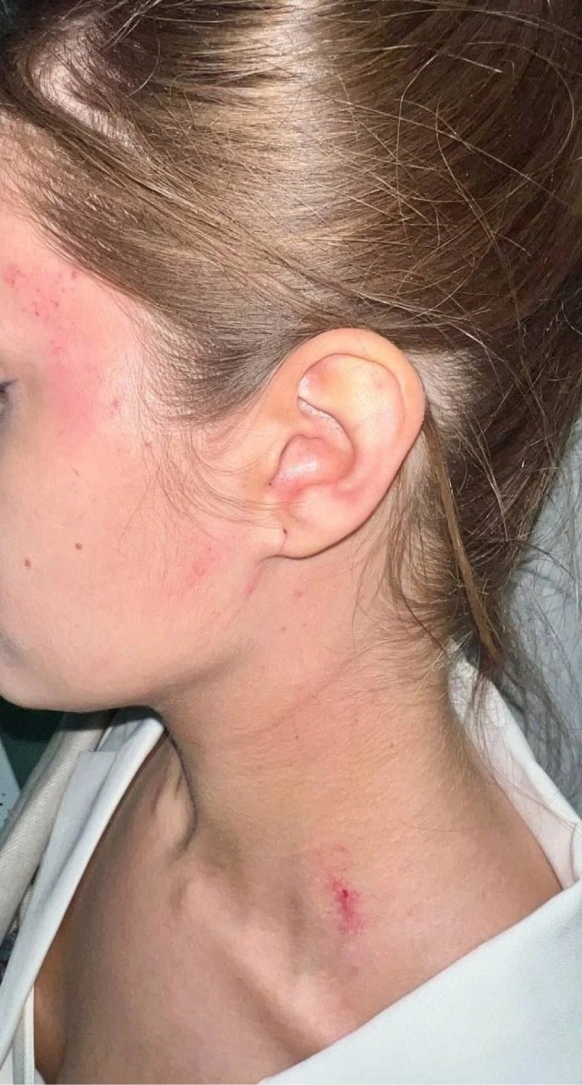 Жених избил во время брачной ночи свою невесту