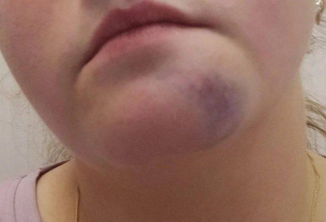 В Питере мужчина чуть не избил мигранта и отвесил оплеуху девушке, которая его защищала