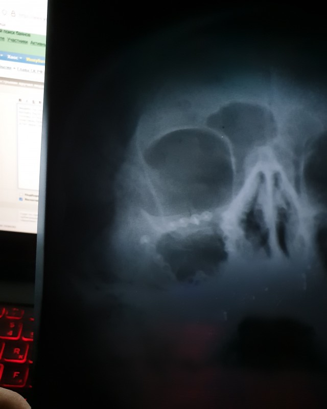 Глава СК РФ Александр Бастрыкин вручил медаль "Доблесть и отвага" Роману Ковалёву, который заступился за девушку в московском метро