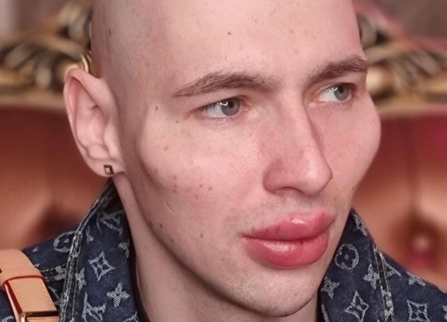 «Ugly»-тату с гнилыми корками и плесенью стали новым трендом у молодых людей