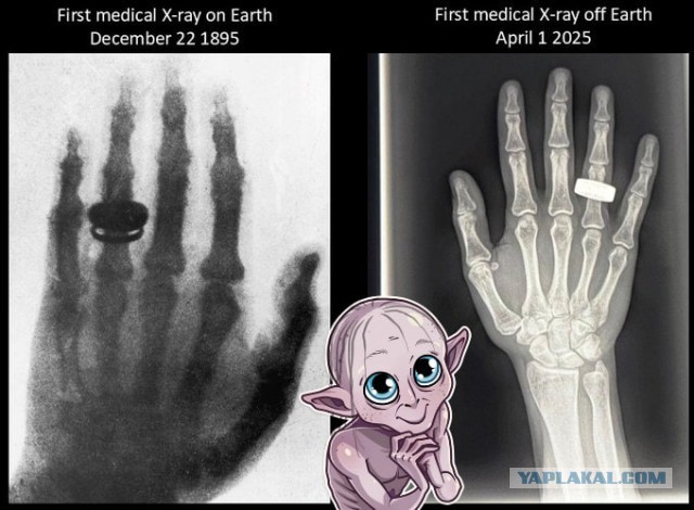 Космические туристы сделали рентген руки.