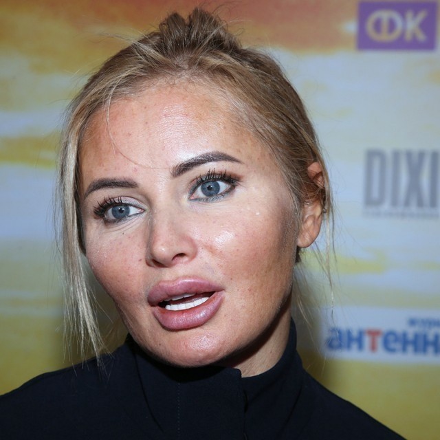 17-летняя дочь 49-летней Даны Борисовой сделала несколько пластических операций. Мама подарила пластику всего тела на 18-тие