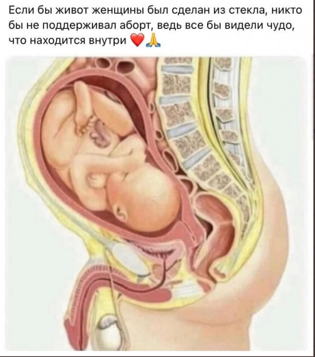 За женой на Филиппины