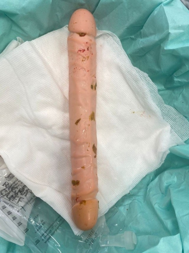 37 летняя женщина едва не погибла после использования экзотического двойного дилдо.