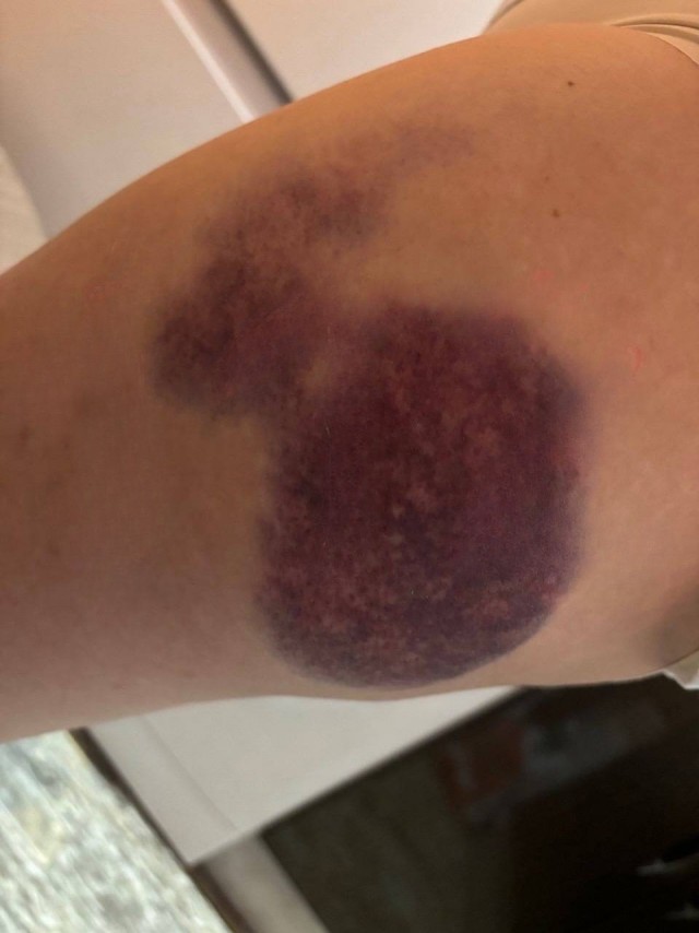 На аэролодке опасно