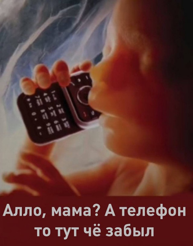 Ребенок родился с противозачаточной внутриматочной спиралью в руке