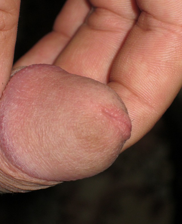 15 фактов про МПХ