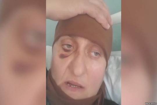 В Калмыкии избили чеченку