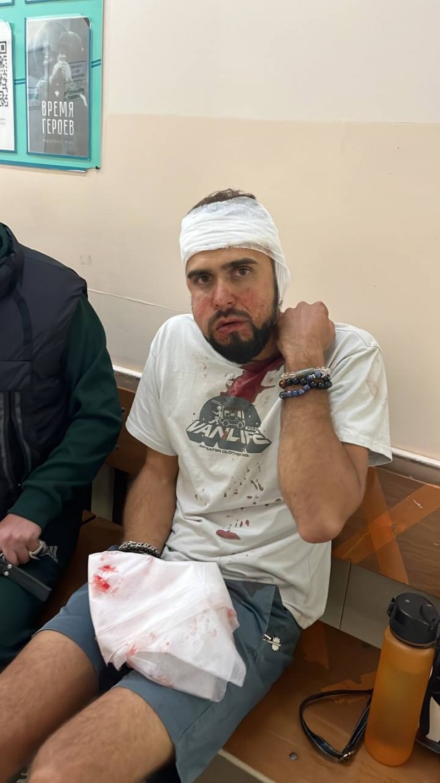 В Приморье новый кавалер женщины избил бывшего мужа, потому что не хотел делать уроки с ребенком