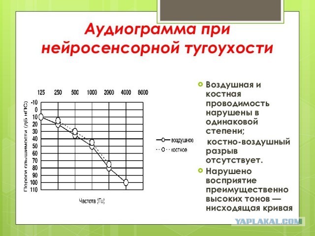 Аудиофилия