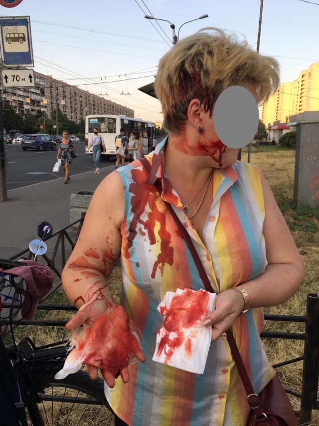 В Петербурге новый скандал из-за самоката, две женщины с переломами