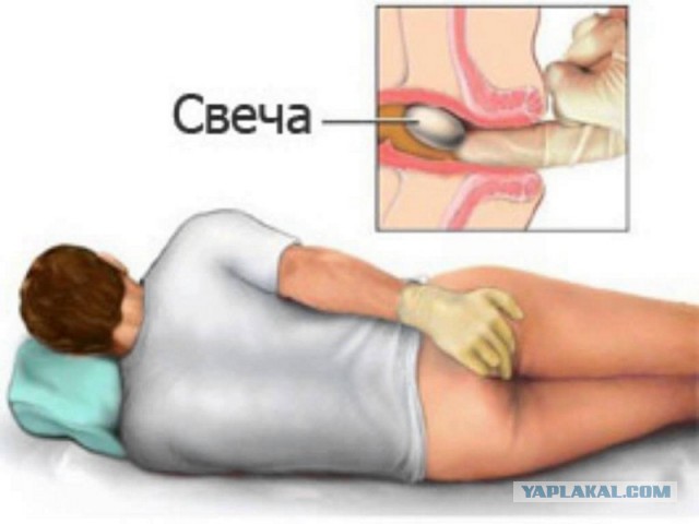 Слепаков про лечение через ж....