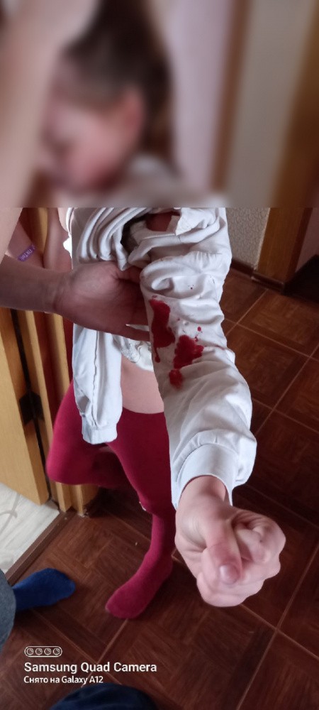 Елец. Стая бродячих собак напала на 9-летнюю девочку