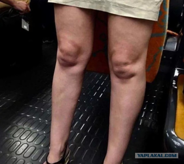 Свекровь подговаривает мужа сделать тест ДНК нашему сыну. Боюсь результата, так как есть грешок