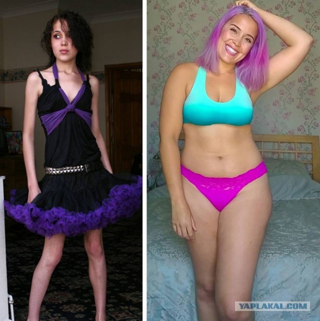 Модель plus-size продемонстрировала разницу между глянцевыми снимками и реальностью
