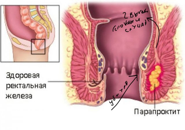 Про гигиену