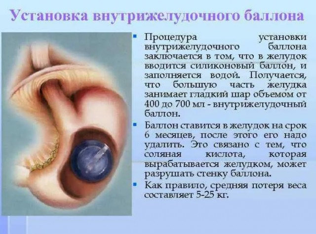 Победная поступь идиотизма по планете – том 9