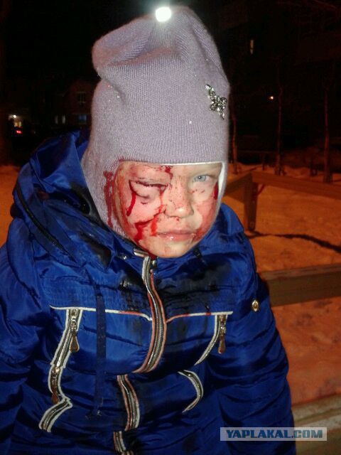 На Урале собака напала на двухлетнего ребенка