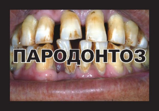 Уже перебор не?