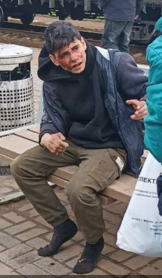 Зацепер получил жуткую травму, когда пытался раскачать токоприёмник поезда