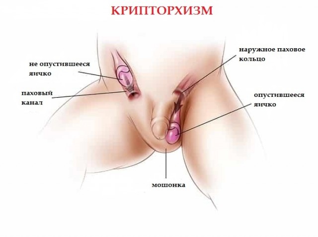 Ремонт яйца. Мои впечатления.