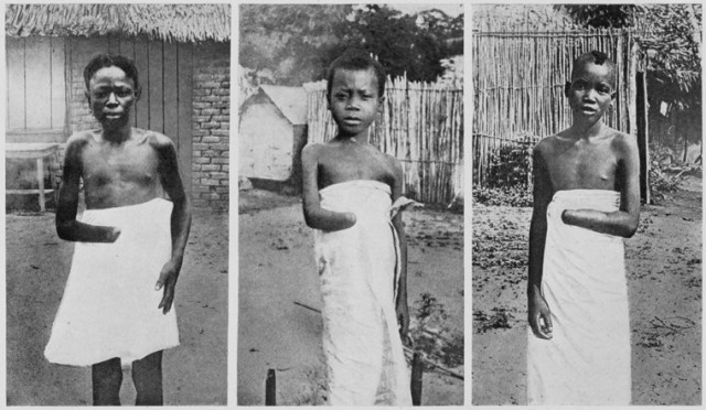 Человеческие зоопарки