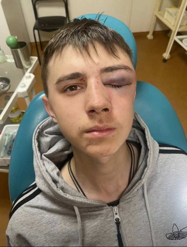 Учитель избил школьника в бурятском селе. Ребёнка пришлось оперировать