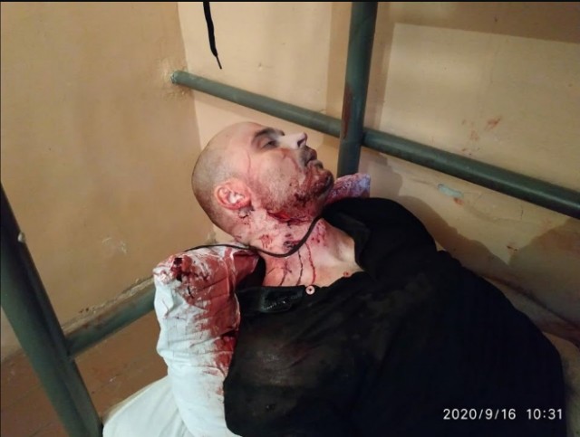 «По голове не бей сильно, трупы не нужны»: москвич жестоко избил бывшую девушку, прыгая на ее голове