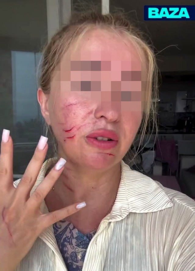 Ревнивая турчанка избила российскую туристку на пляже из-за подката мужа — девушку увезли на скорой