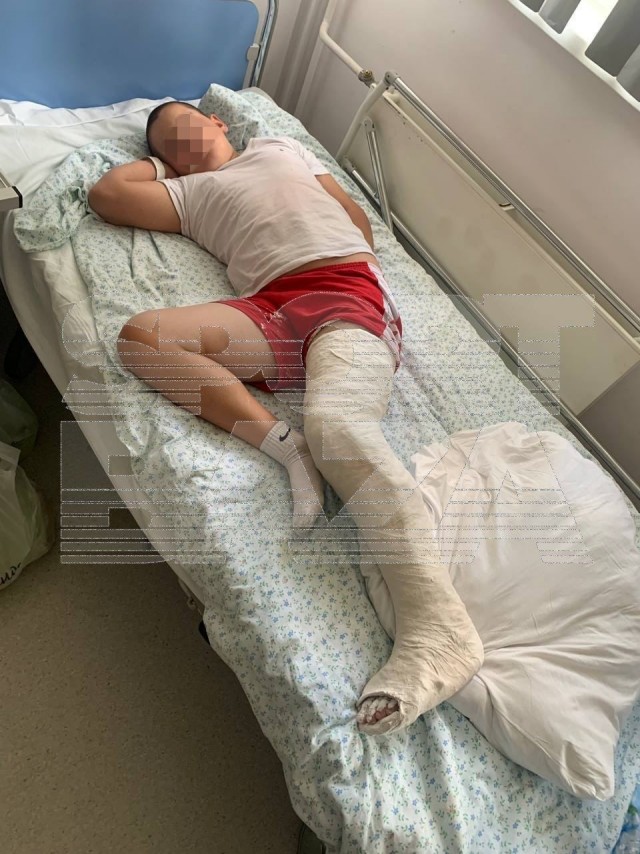 12-летний самбист из Мытищ сломал ногу сопернику во время тренировки