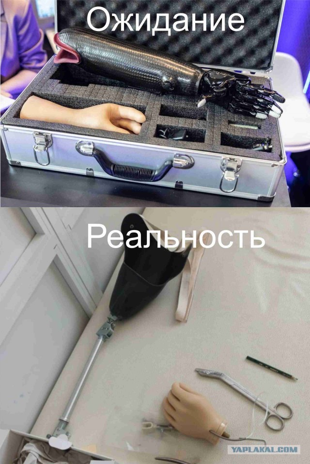 Российский протез руки за 5 млн. рублей