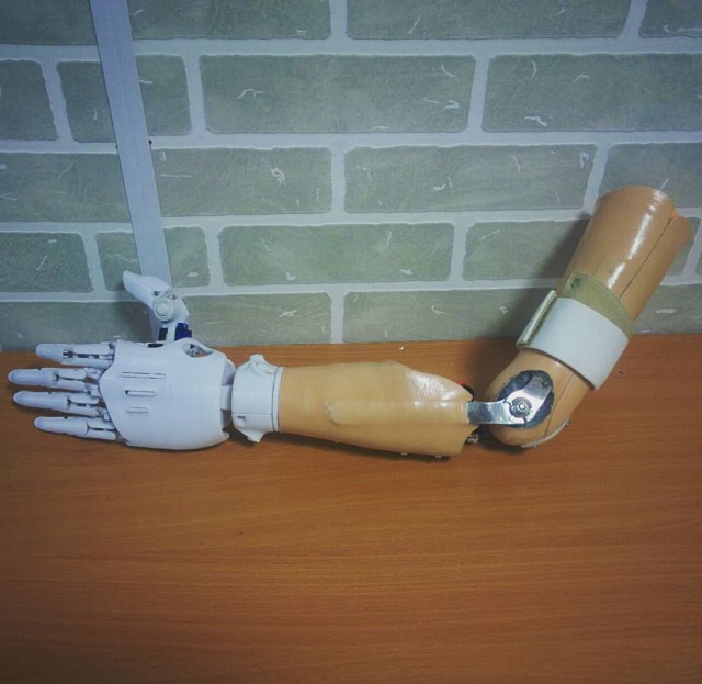 Якутяне сделали бионический протез руки, распечатанный на 3D-принтере