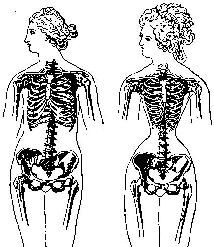 История корсета