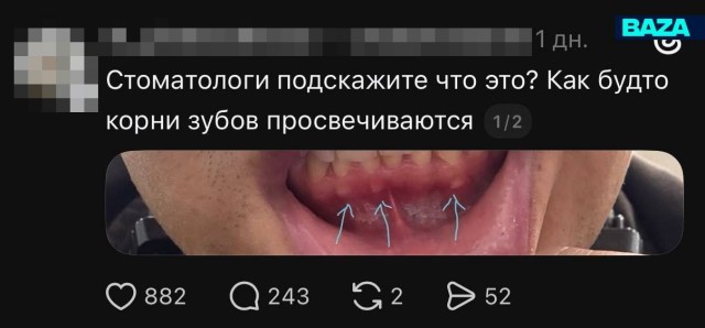 Зумеры и миллениалы начали искать врачей среди своих подписчиков, чтобы сэкономить на походах в клиники