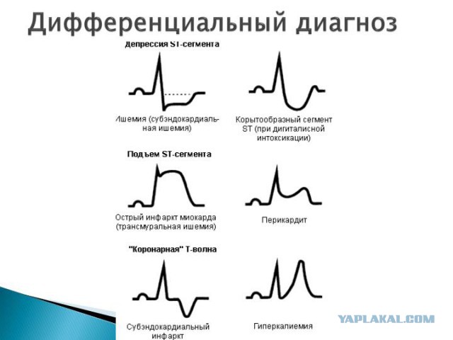 Только лег с намерением выспаться! И так каждую ночь...
