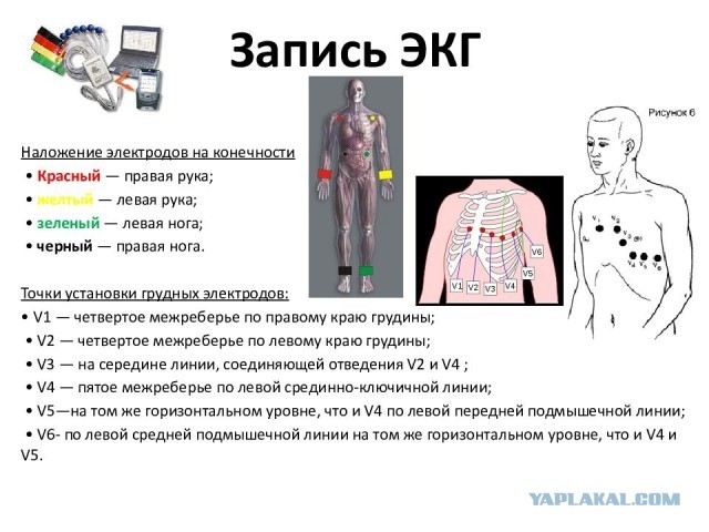 Тесты техника снятия экг