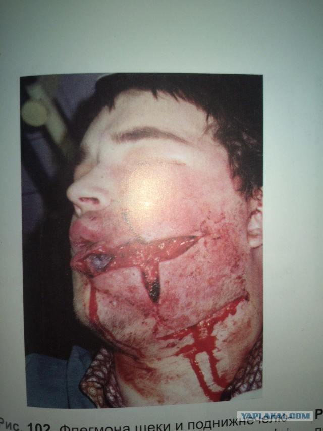 «Я пережил пытки в реанимации и остался инвалидом»