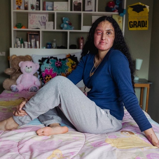 Плеснувший девушке кислотой в лицо негритос задержан спустя 5 лет. Все это время его искали.