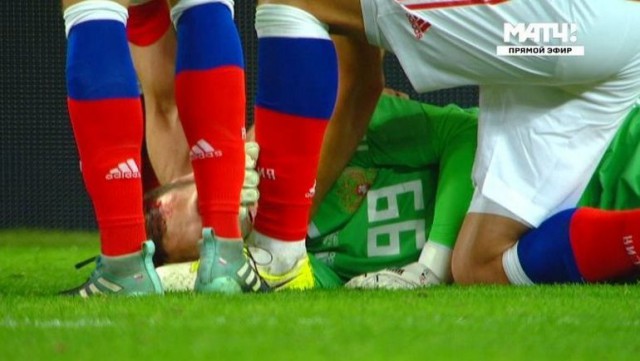 Вратарь сборной России получил тяжелую травму во время матча с Испанией