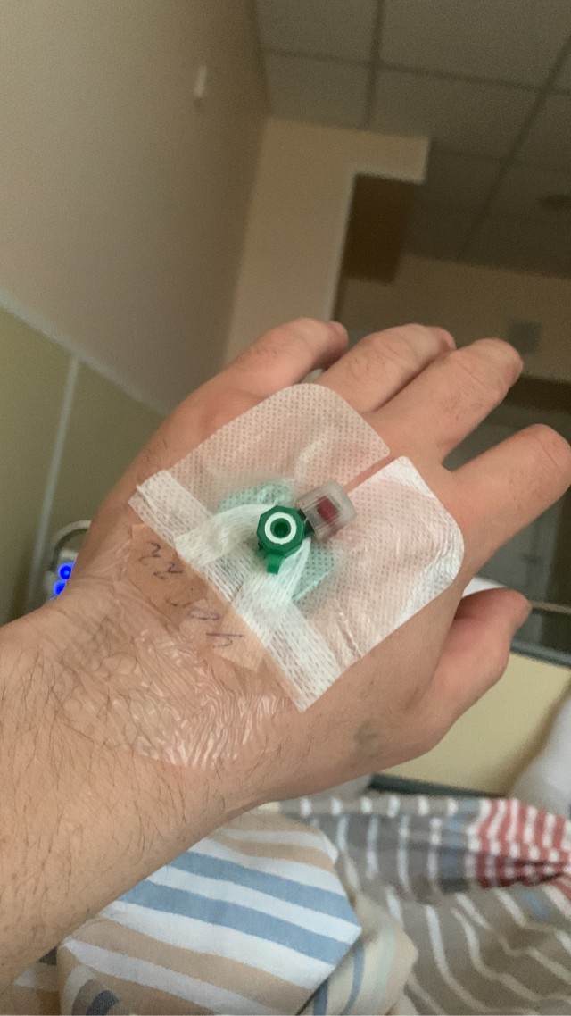 Рука водителя погрузчика после операции нейрохирургии