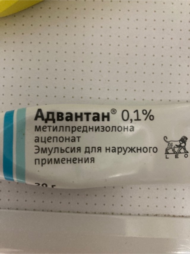 Что у Володи с лицом?