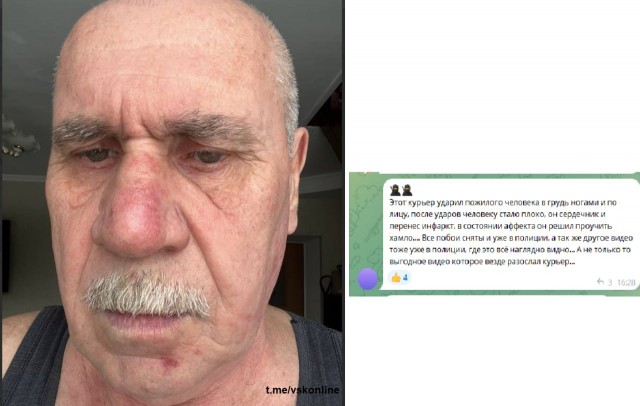 В Воскресенске лютый дед продырявил руку и отстрелил палец курьеру Озона