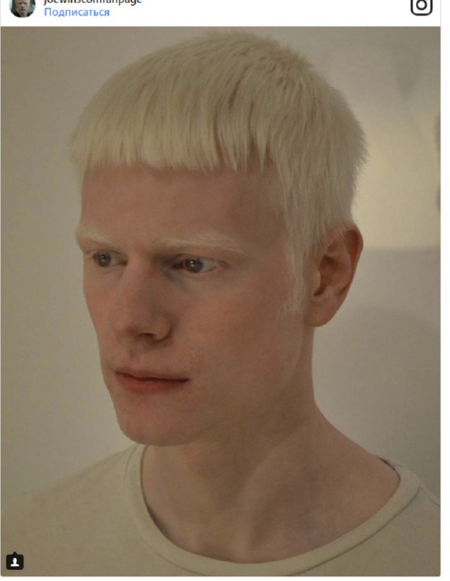 Как выглядят альбиносы разных рас?