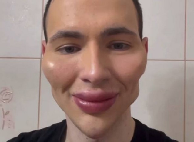 Скулы базуки