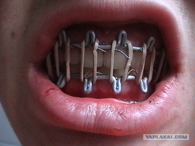 История из реальной жизни